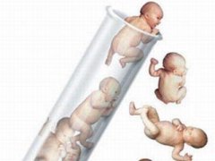 重庆云阳县三代试管婴儿可以筛选性别吗？需要花费多少钱？