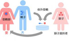广州市三代试管的着床率提升得如此